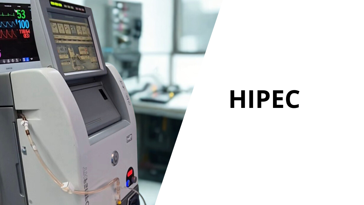 Quimioterapia Intraperitoneal Hipertérmica HIPEC